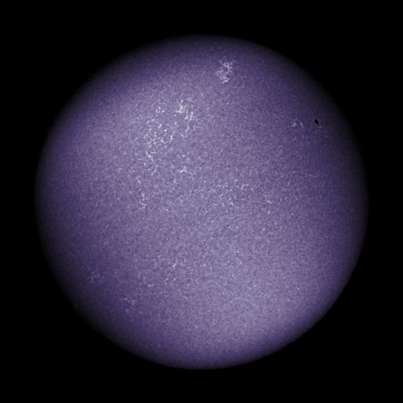 Colorized (Calcium+Iron+CH (G))