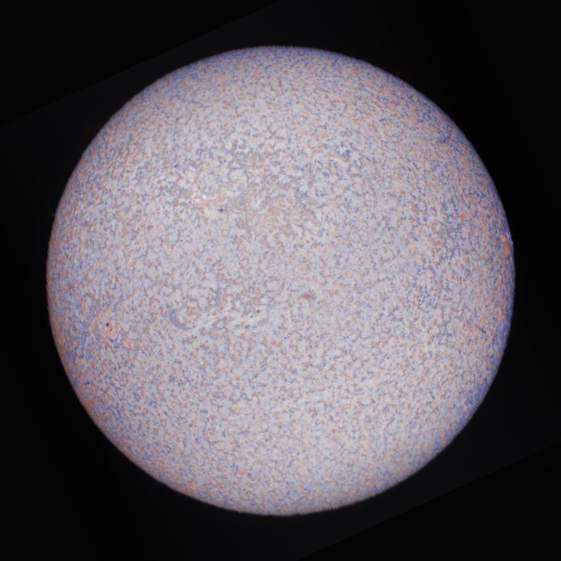 Doppler (rotation corrected)